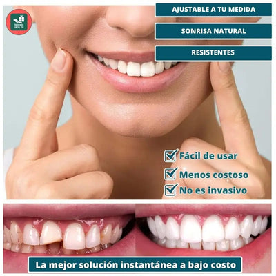 Carillas Dentales Ajustables 🦷- Set 2 Pzs (Superior e Inferior)