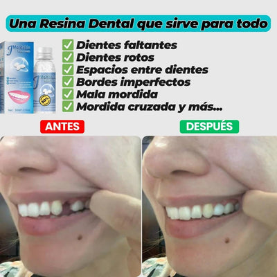 Resina Dental Moldeable: Sonrie Sin Miedo 💫
