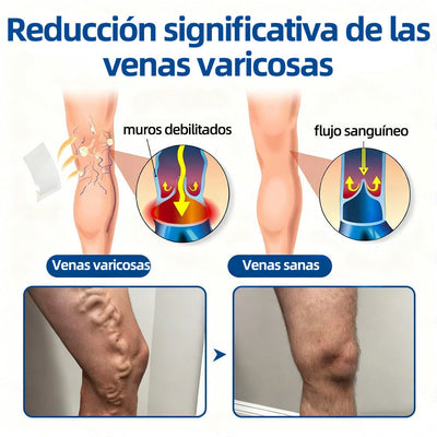 Varicose PATCH™ - Parches Antivarices (Pack x 8 unidades)