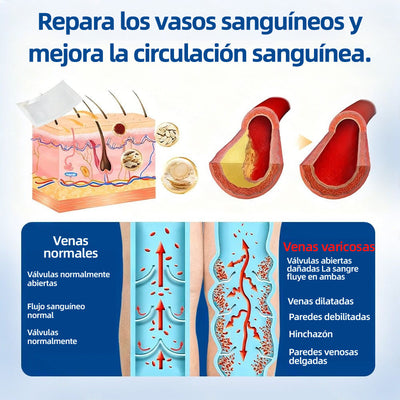 Varicose PATCH™ - Parches Antivarices (Pack x 8 unidades)