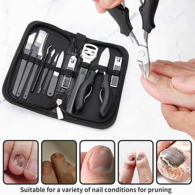 Kit Herramientas Uñas Encarnadas Set Corta Uñas 11pz